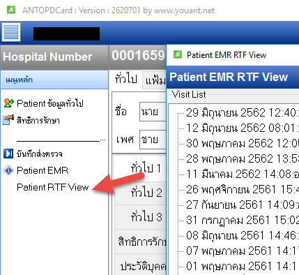 ANTOPDCard สำหรับ HOSxP v3 ระบบเวชระเบียน รุ่น Beta (620701)