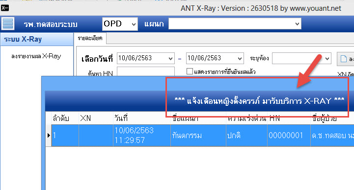ANTXRay [v630610] ระบบเอกซเรย์ แยก สำหรับ HOSxP v3